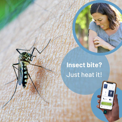 heat it™ - The world’s first smartphone-powered insect bite relief device